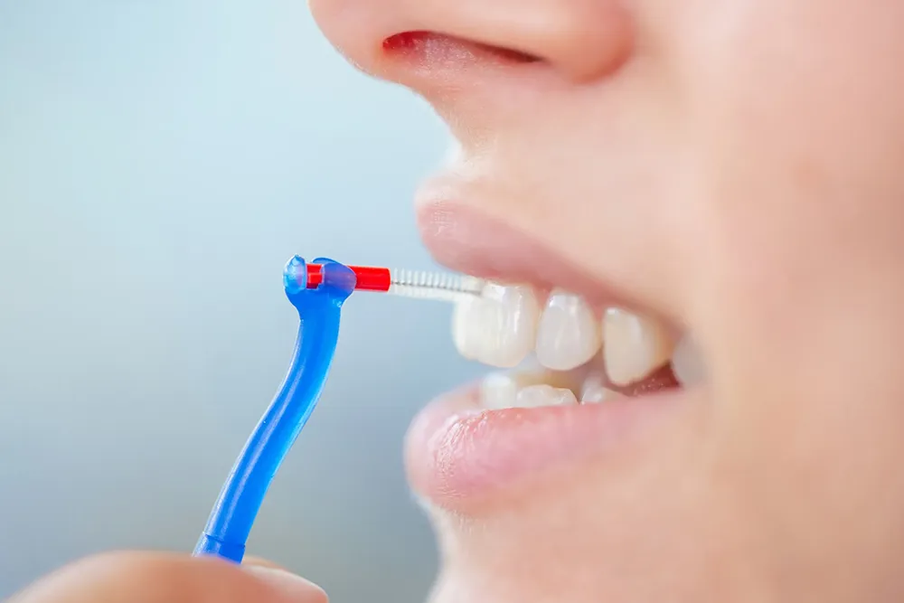 Il modo corretto di utilizzare uno scovolino interdentale